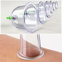 Picture of Qnh (6 Cups + 1 Suction Pump) Chinese Medical Vacuum Cans Cupping